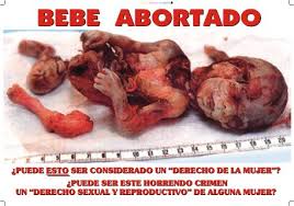 bebe abortado